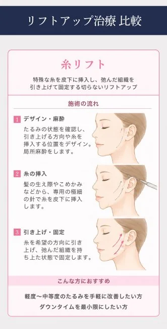 【期間限定】 ミニフェイスリフトキャンペーン