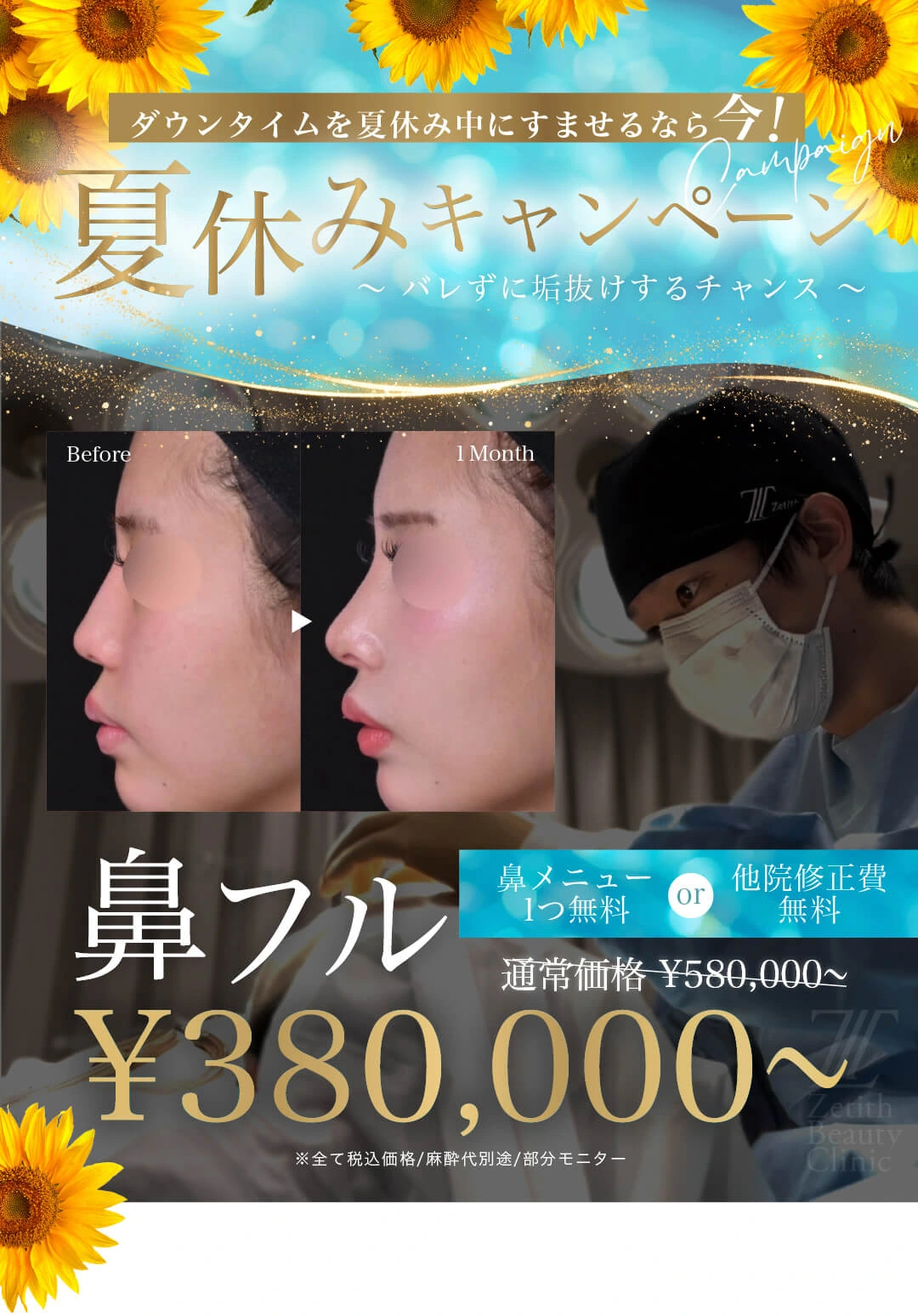 จำกัดสำหรับดร.เฮน:แผนราคาคงที่จมูก2026ของขวัญแคมเปญฤดูร้อน