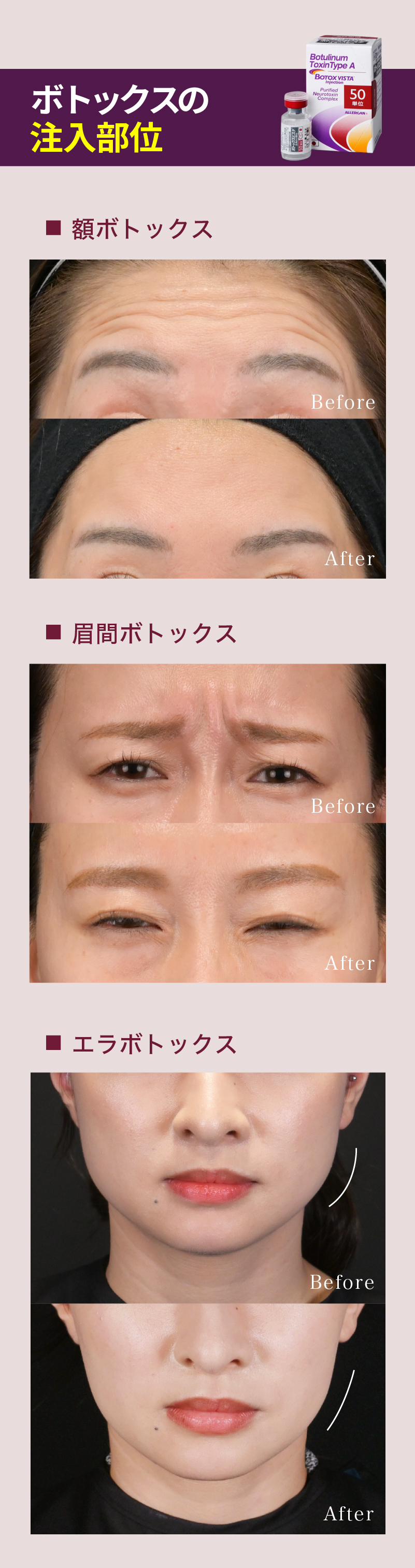 アートボード 8-100.jpg