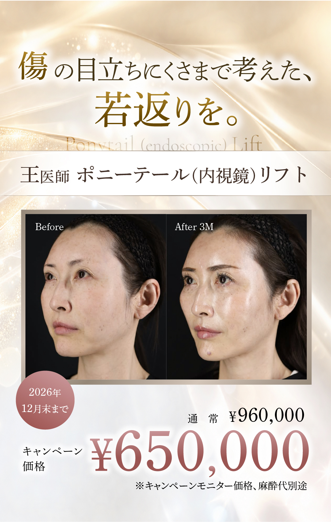 アートボード 8-100.jpg