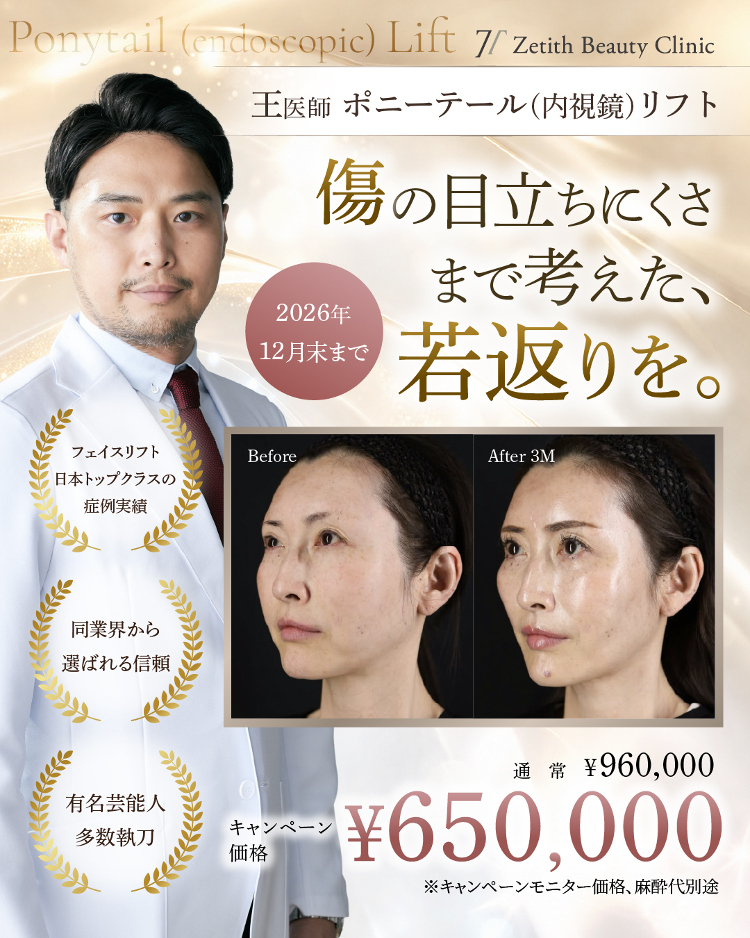 【王医師】ポニーテール(内視鏡)リフト