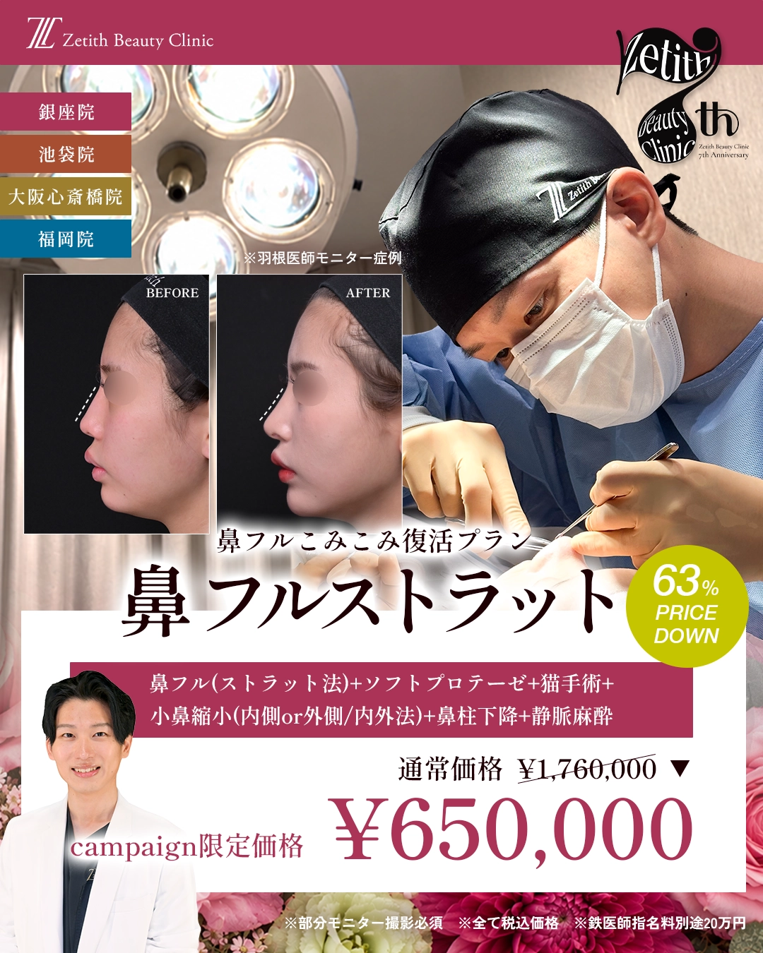 【Zetith7周年】鼻フル67%OFF
