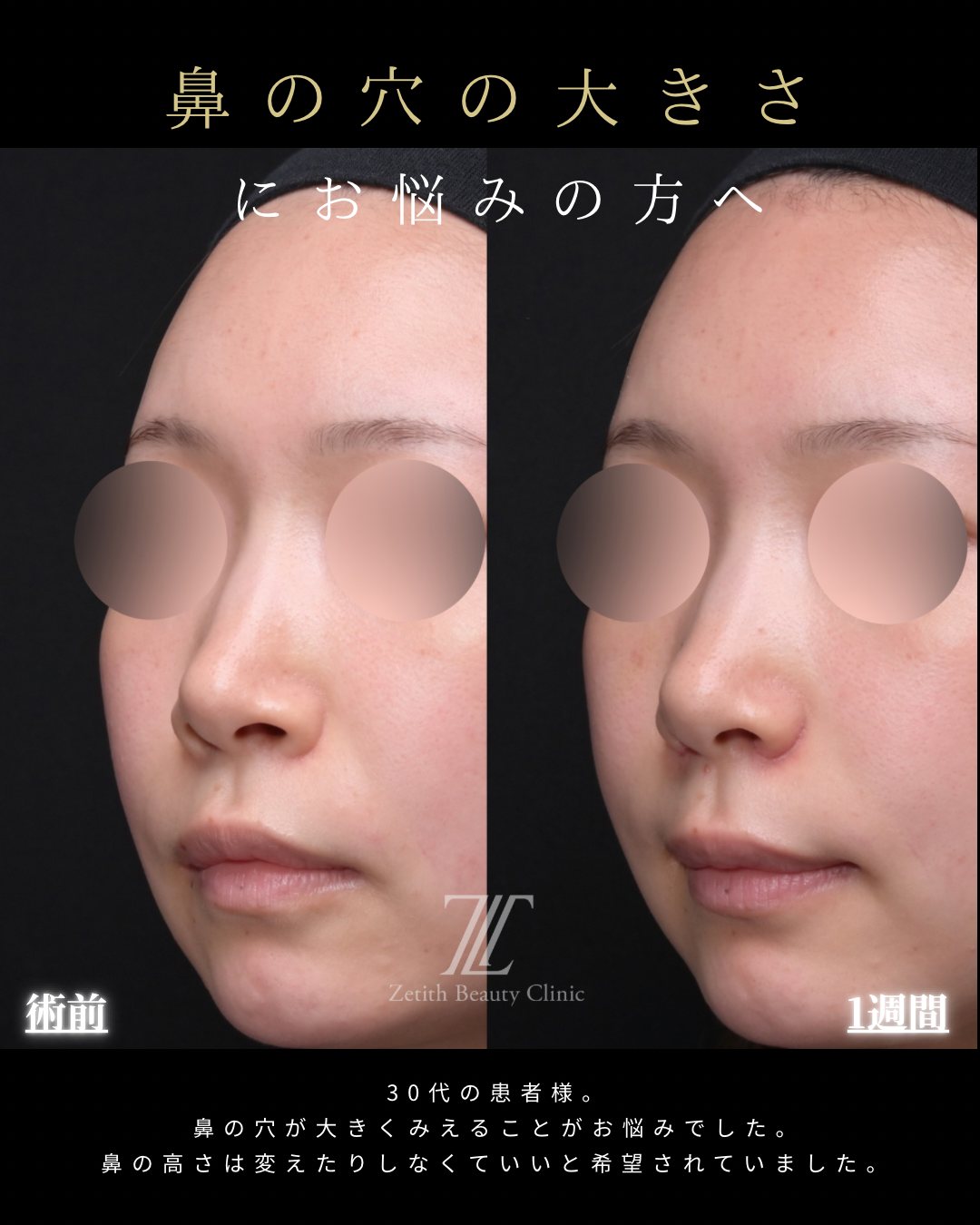 錻翌瞮å°ã®çäŸ æã è¡åã»è¡åŸ