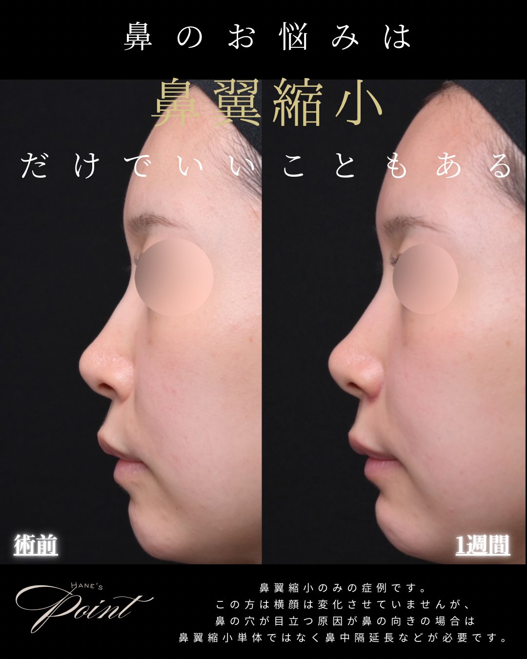 錻翌瞮å°ã®çäŸ æšª è¡åã»è¡åŸ