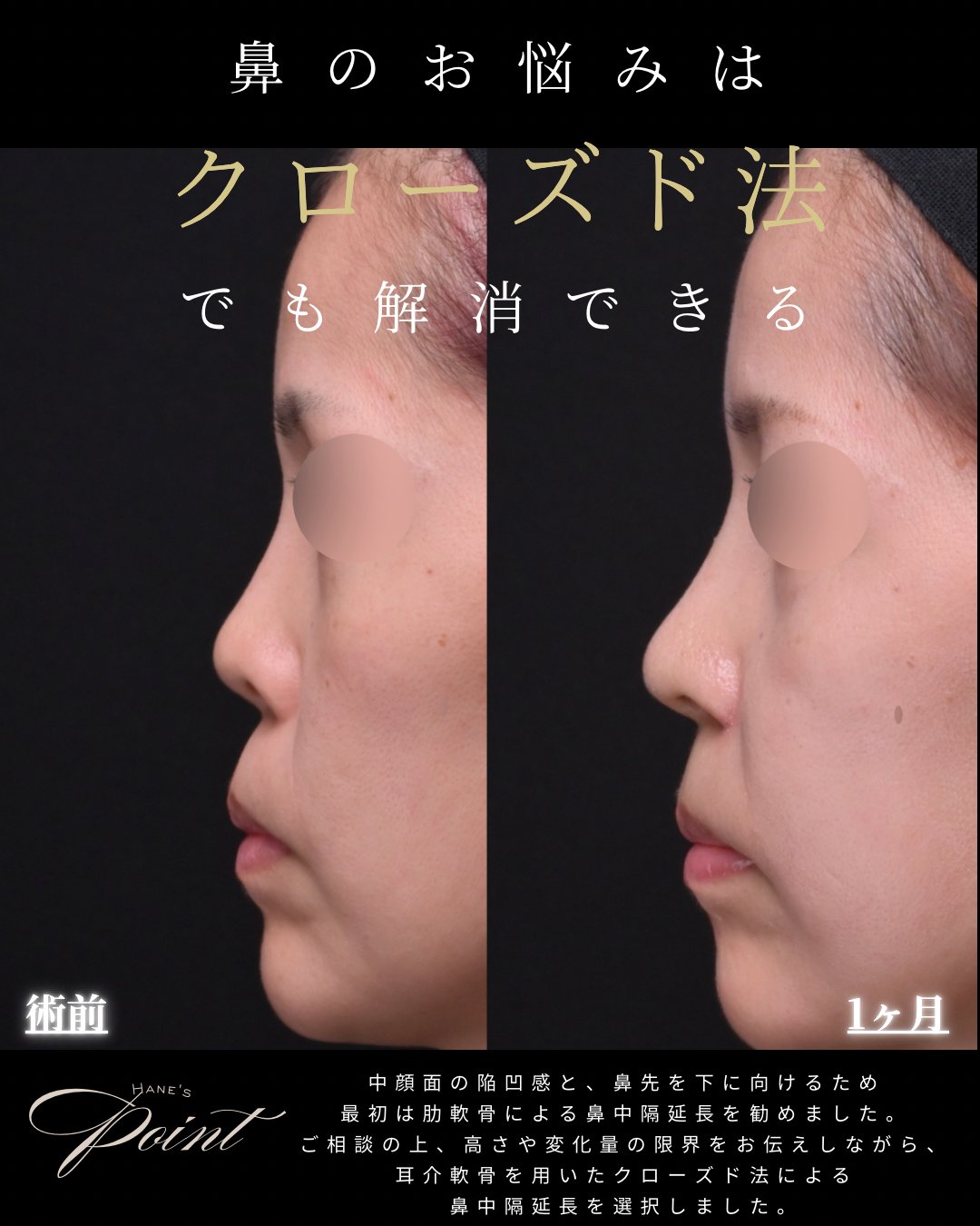 猫手術を含む症例（横顔）
