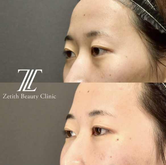 若返り エイジングケア アーカイブ ゼティスビューティークリニック 鼻整形 鼻形成 美肌専門美容クリニック