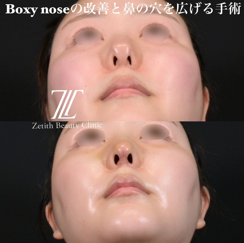 鉄 鑠 アーカイブ ゼティスビューティークリニック 鼻整形 鼻形成 美肌専門美容クリニック
