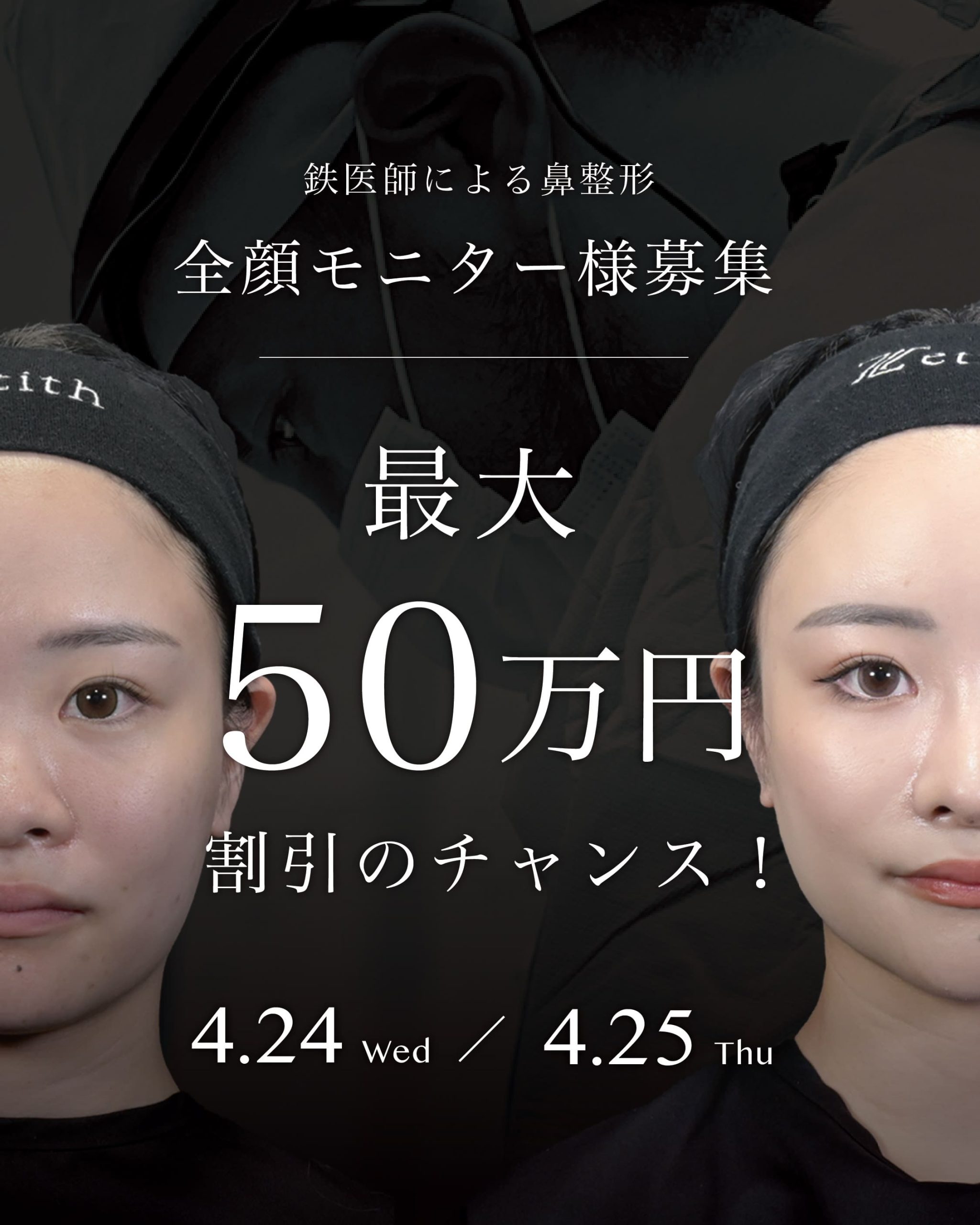 【4/24,25限定】鉄医師による鼻整形の全顔モニター募集&交通費補助