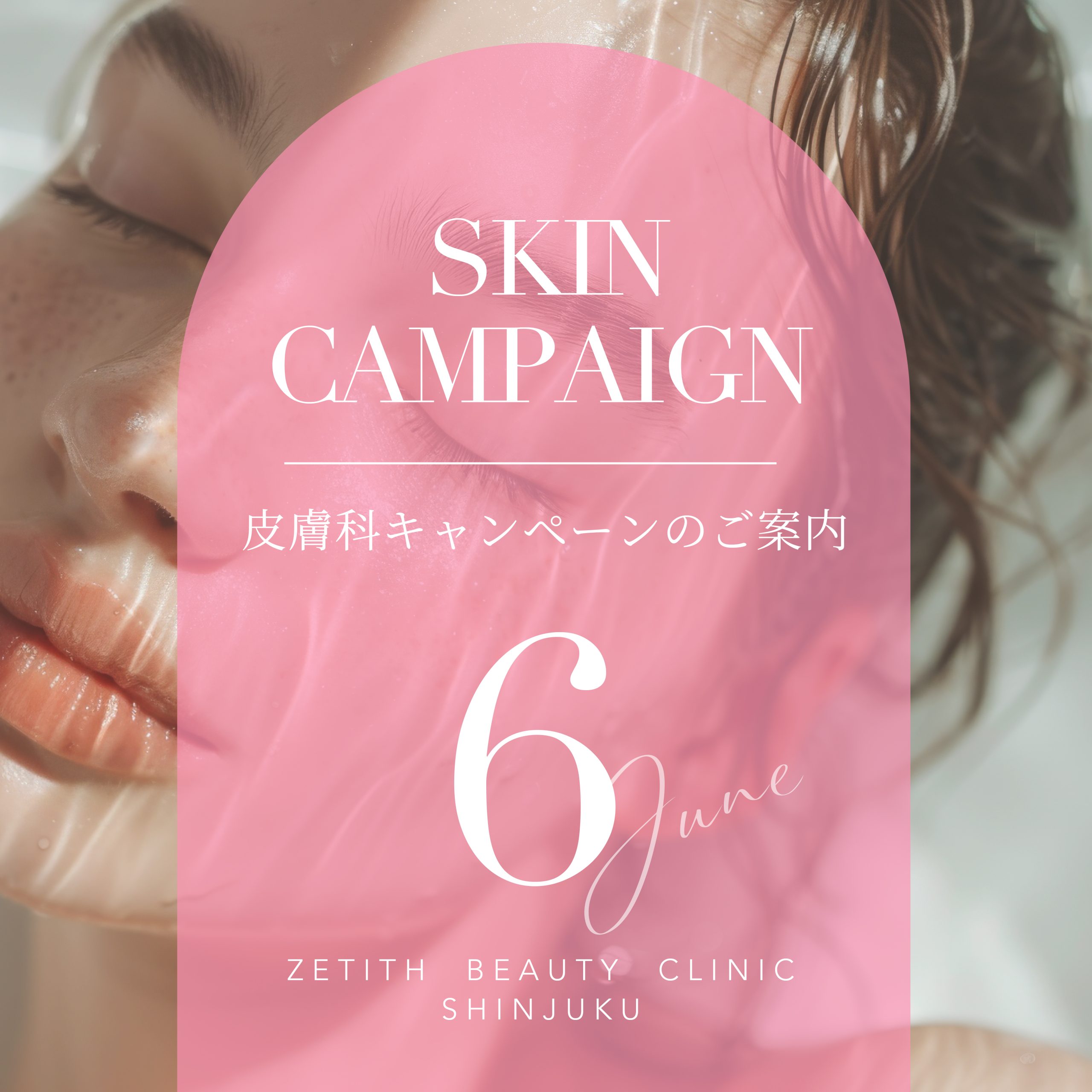 全身美肌で夏を迎えましょう！6月限定皮膚科キャンペーン