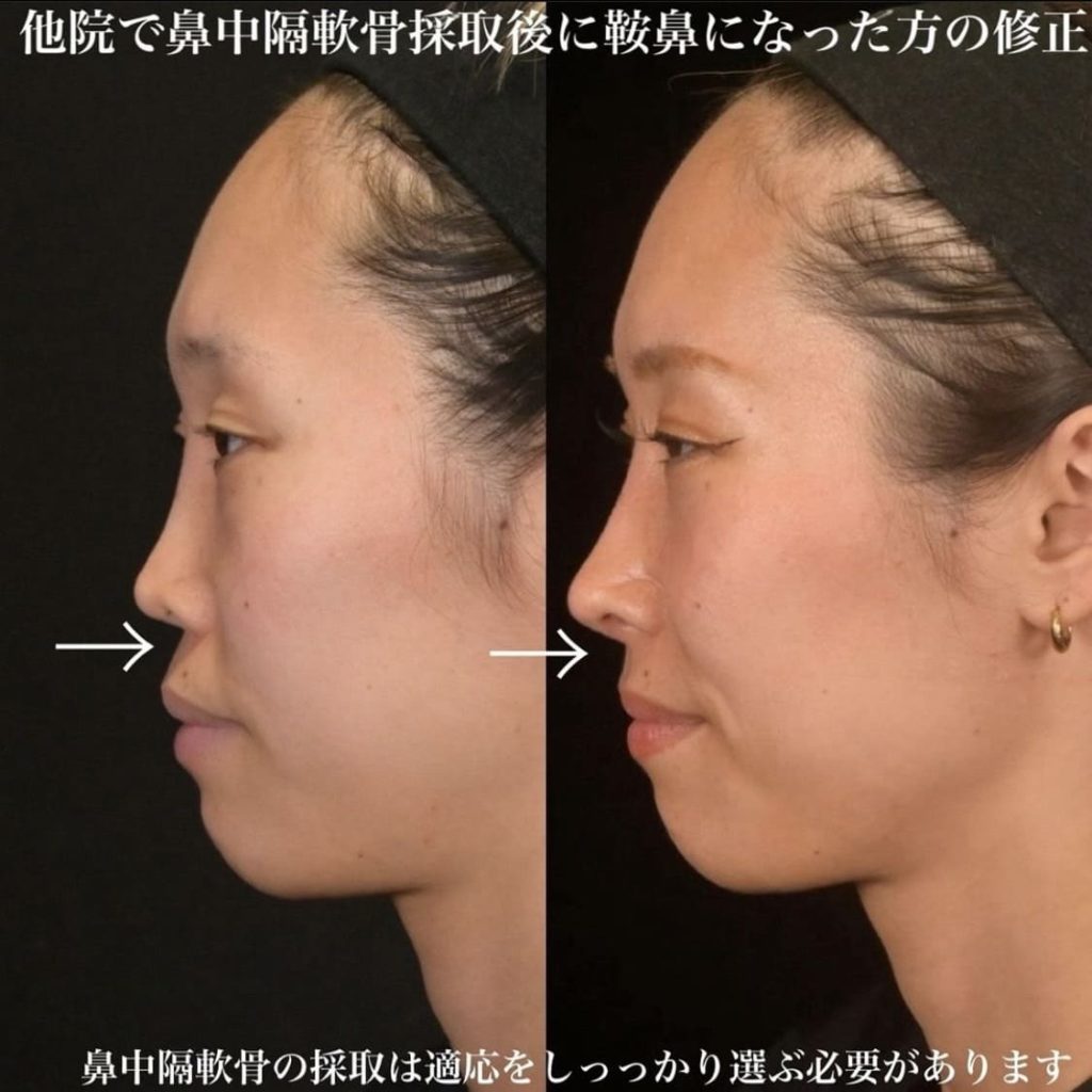 他院修正