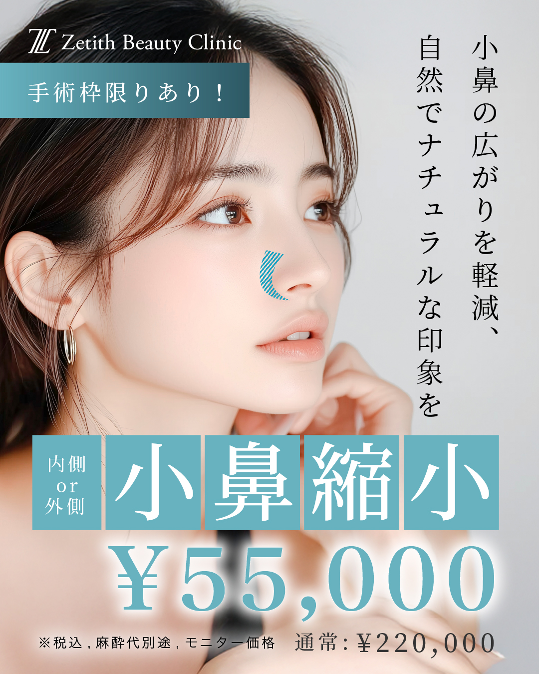 小鼻縮小が55,000円で受けられる!
