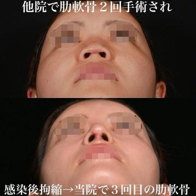 他院修正