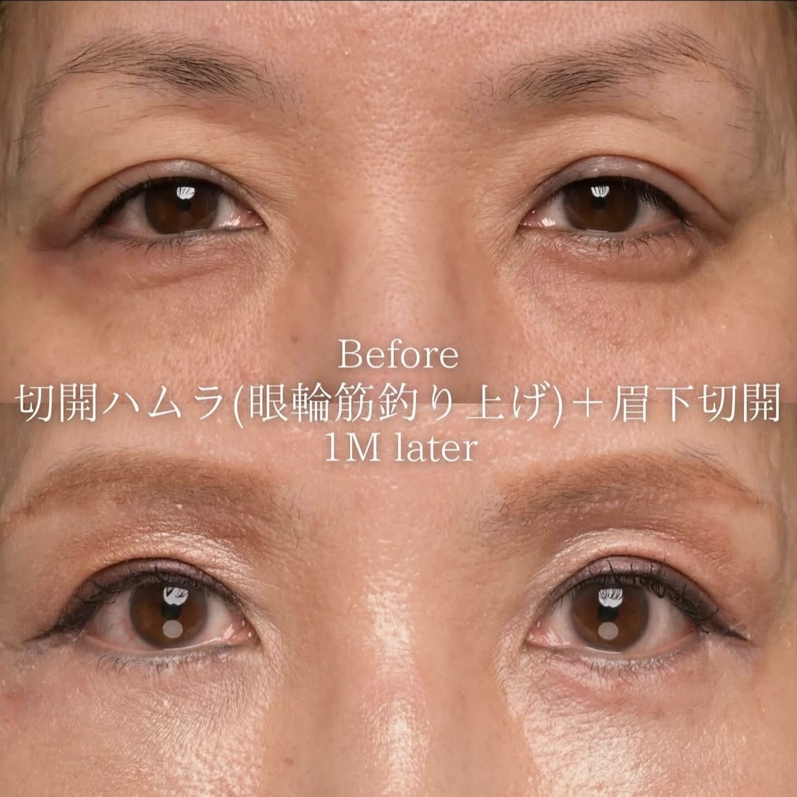 目元のビフォーアフター写真