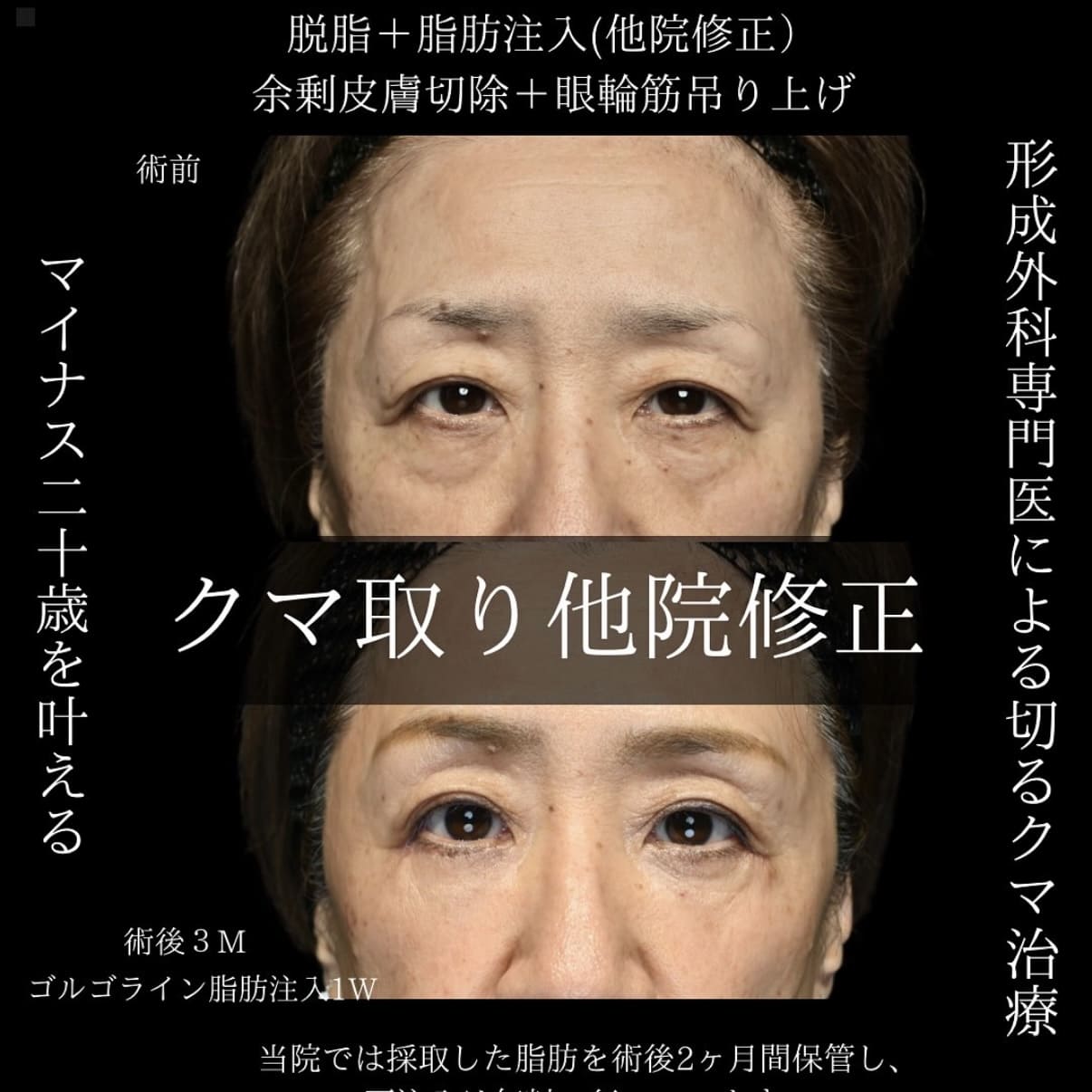 クマ取りのビフォーアフター写真