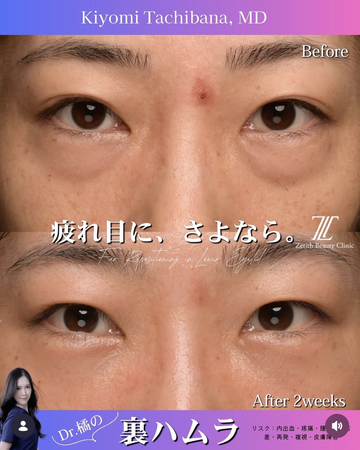 裏ハムラのビフォーアフターの写真