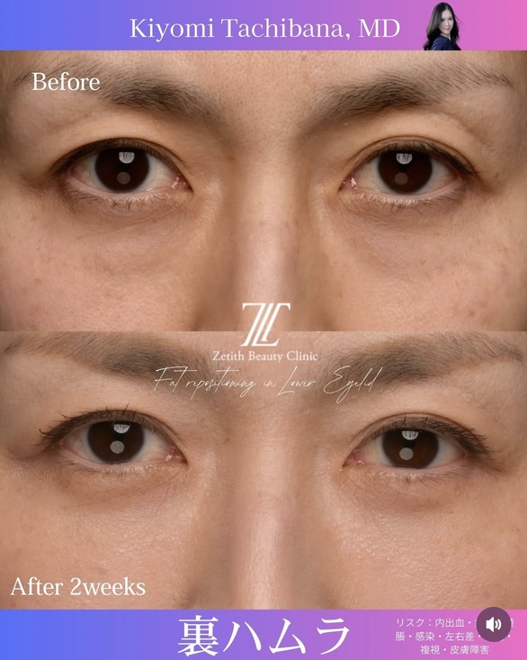 裏ハムラのビフォーアフターの写真