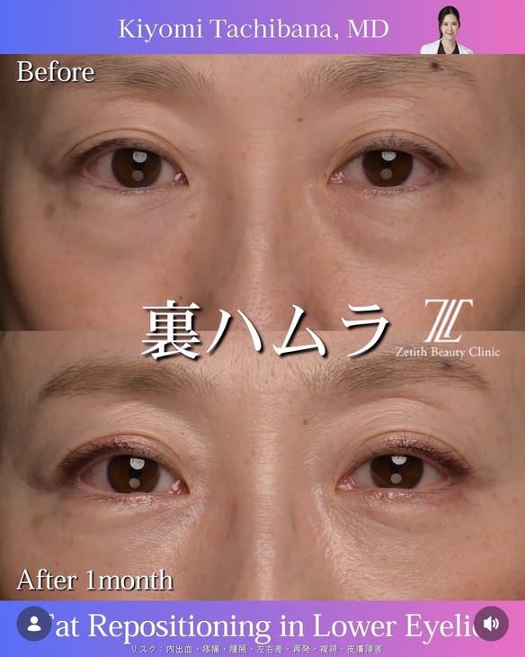 裏ハムラのビフォーアフターの写真
