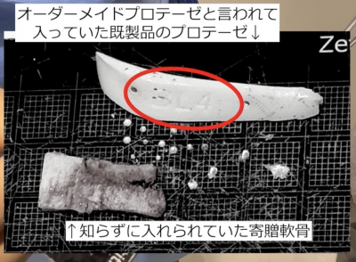寄贈軟骨
