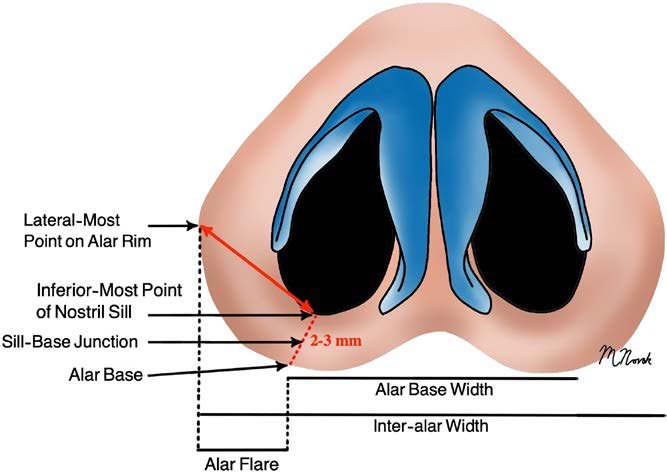 . Key anatomical landmarks of the basal view. Alar flare is