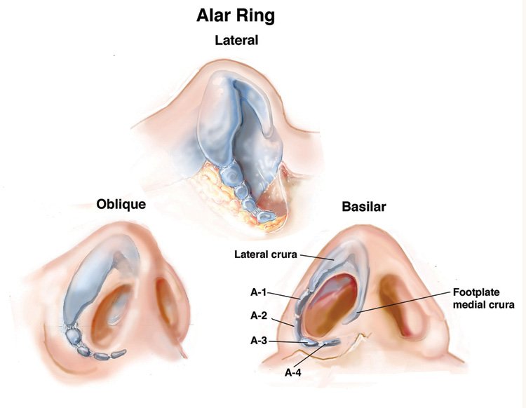 鼻翼軟骨（Alar Ring）の3方向解剖図