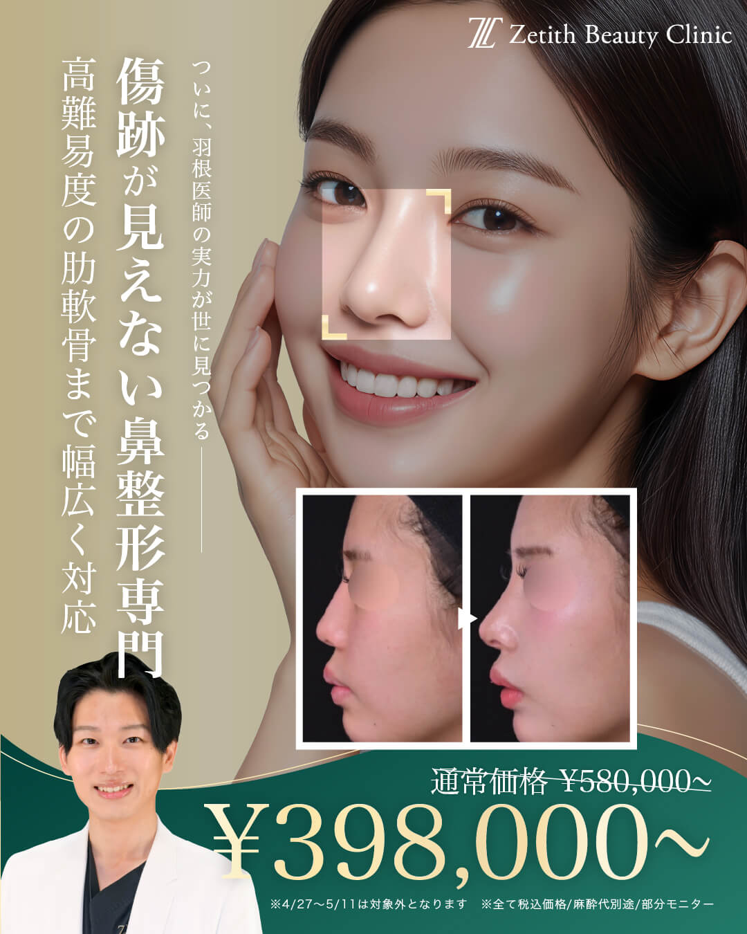 期間限定>鼻フル定額|特別キャンペーン