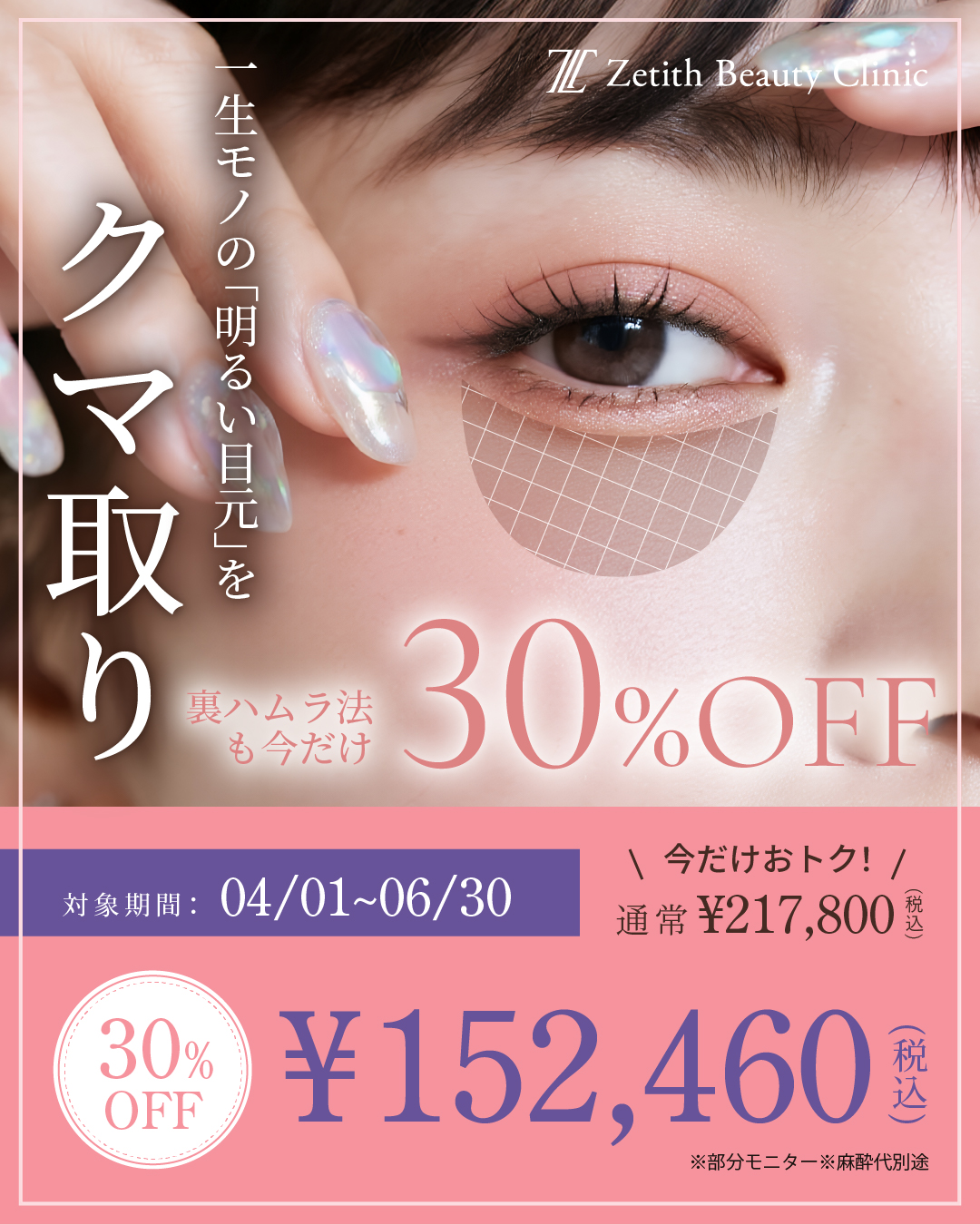 【関東限定】クマ治療30%OFF!