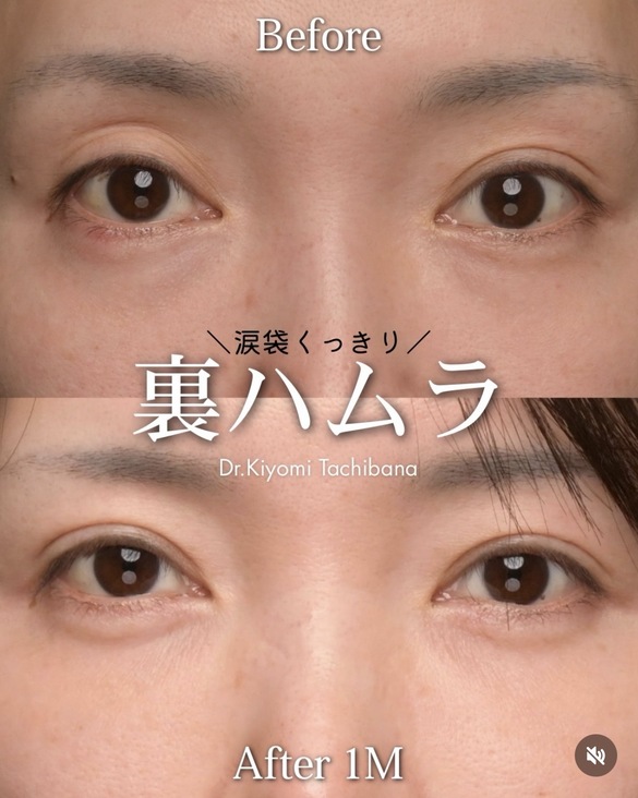裏ハムラのビフォーアフターの写真
