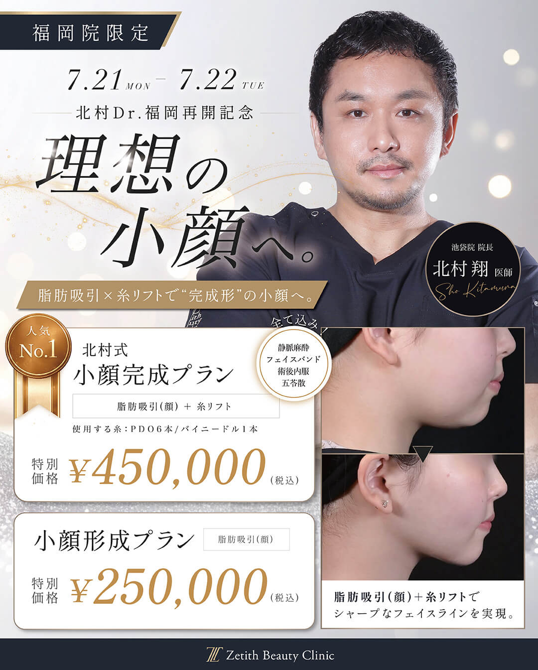 福岡院出張再開記念｜北村医師による小顔キャンペーン