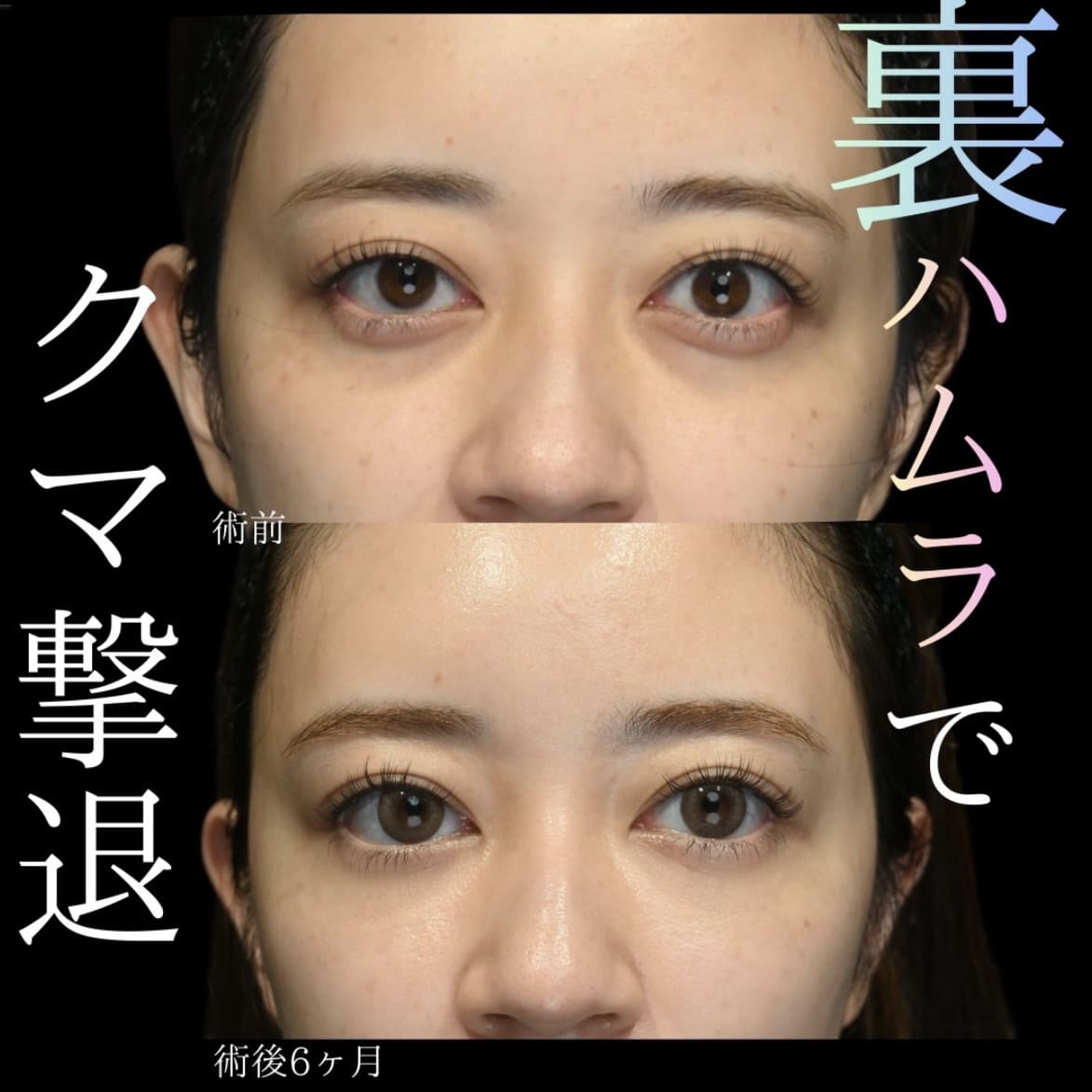 裏ハムラのビフォーアフター写真