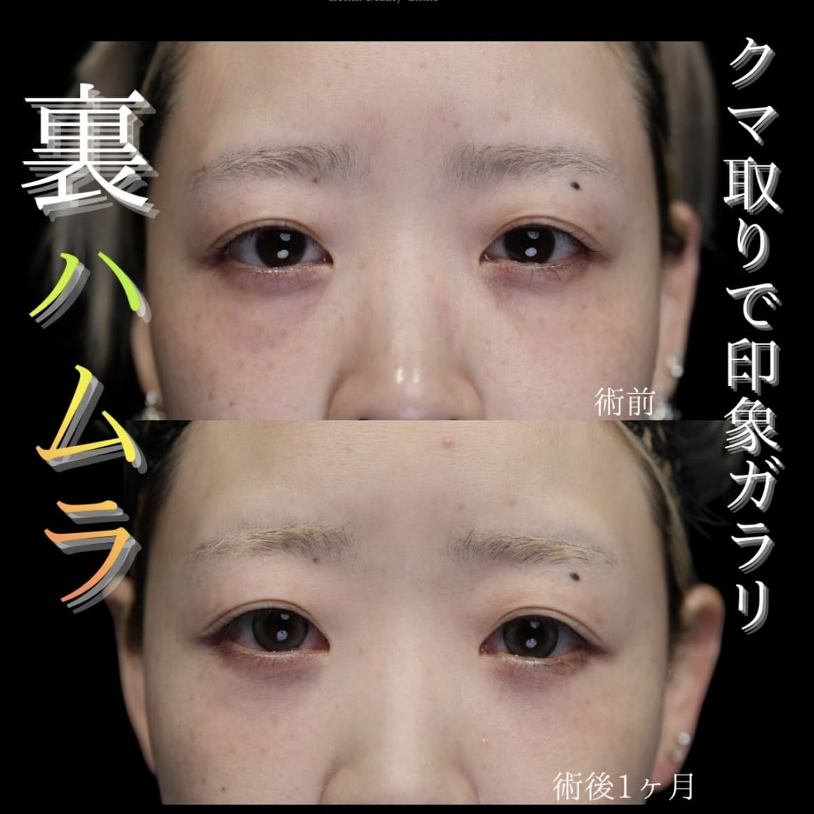 裏ハムラのビフォーアフター写真