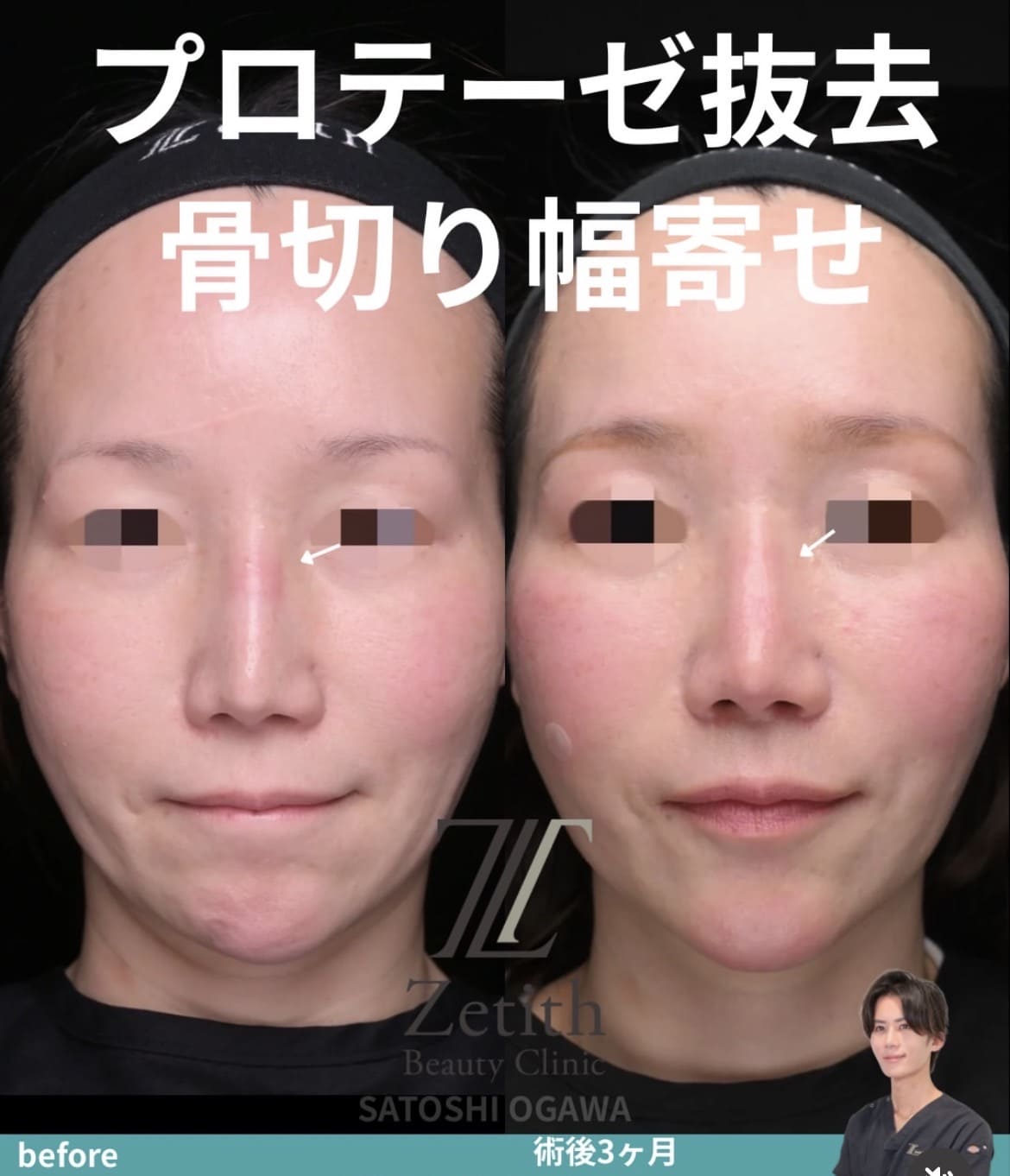 ゼティスビューティークリニック｜鼻整形・鼻形成、美肌専門美容クリニック