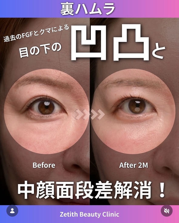 裏ハムラのビフォーアフターの写真
