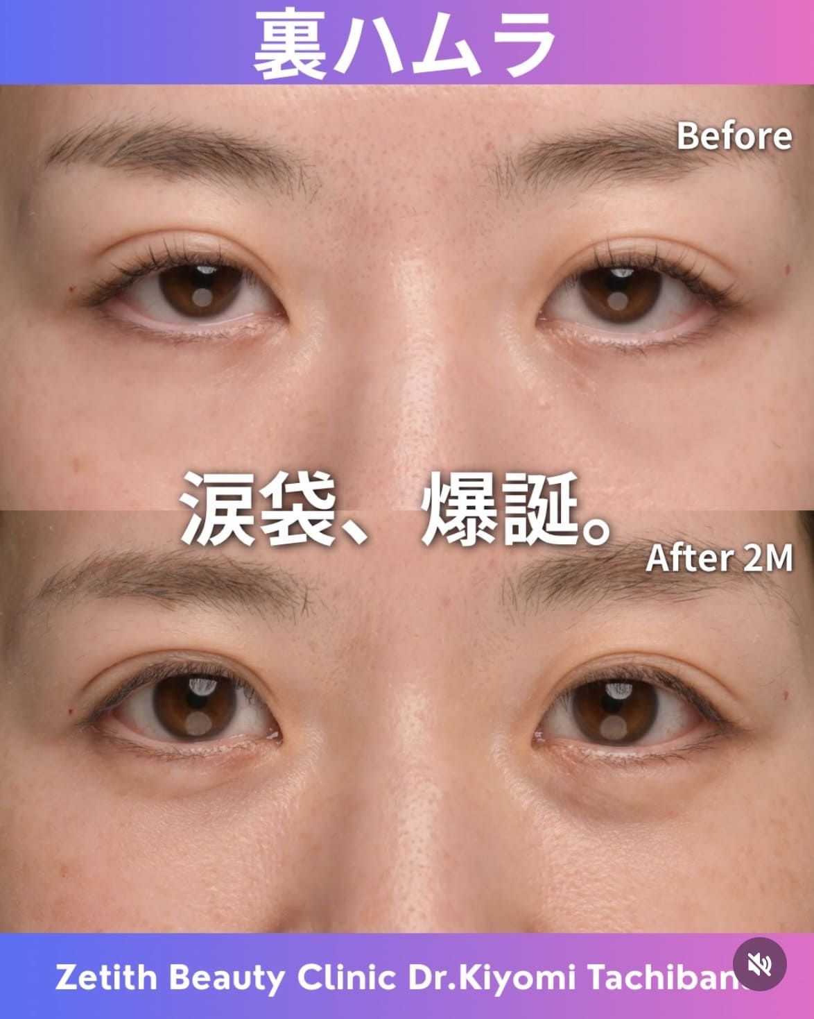 裏ハムラのビフォーアフターの写真