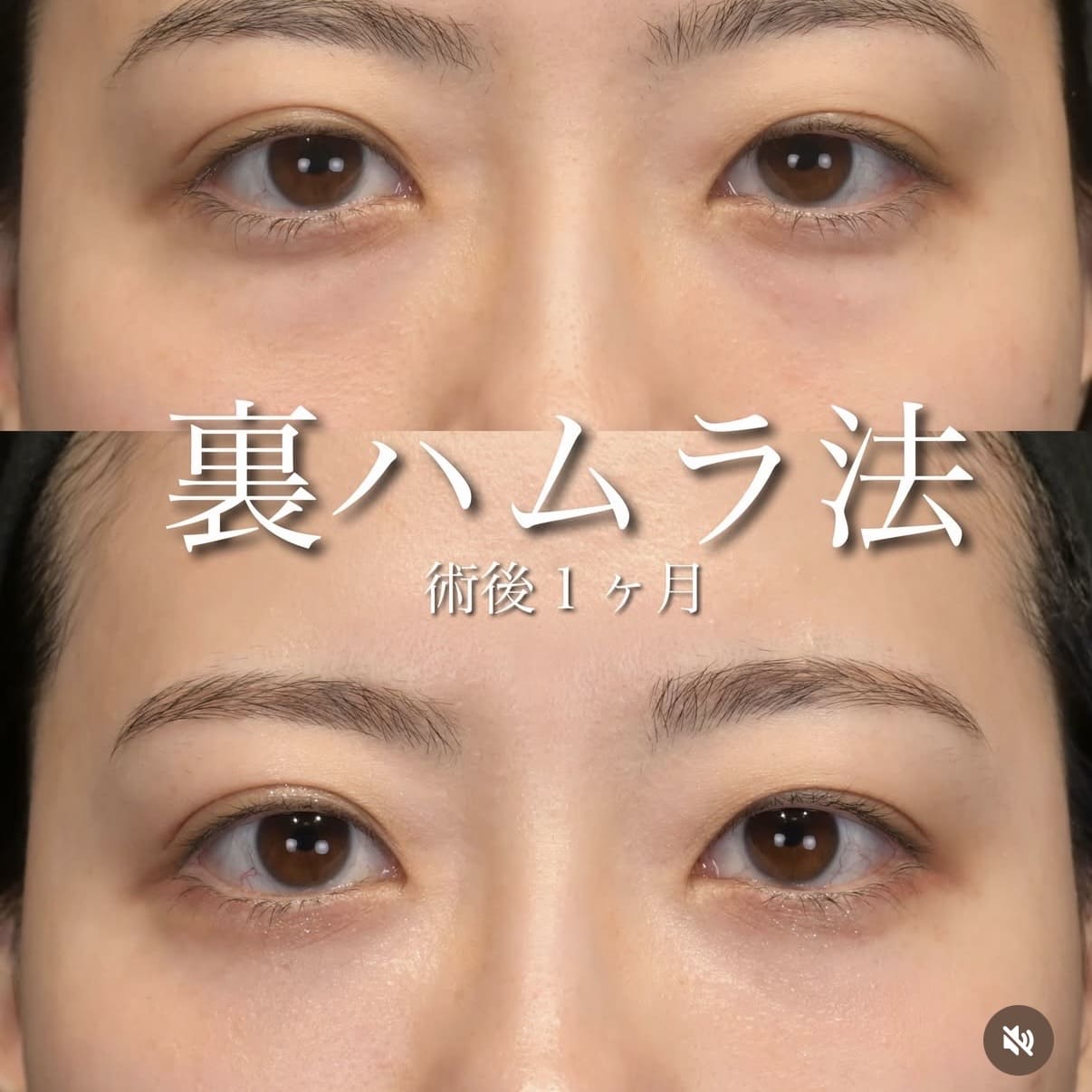 裏ハムラのビフォーアフター写真