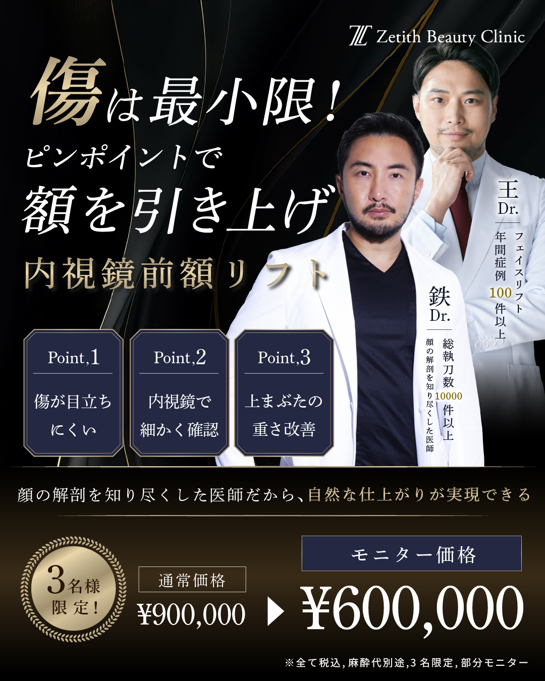 内視鏡前額リフト