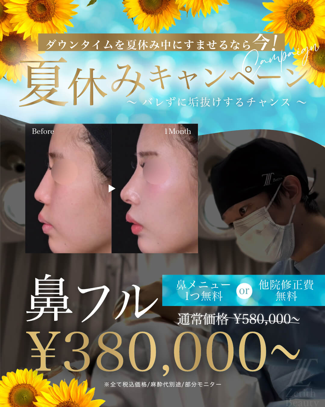 【福岡院】鼻整形｜夏休みキャンペーン
