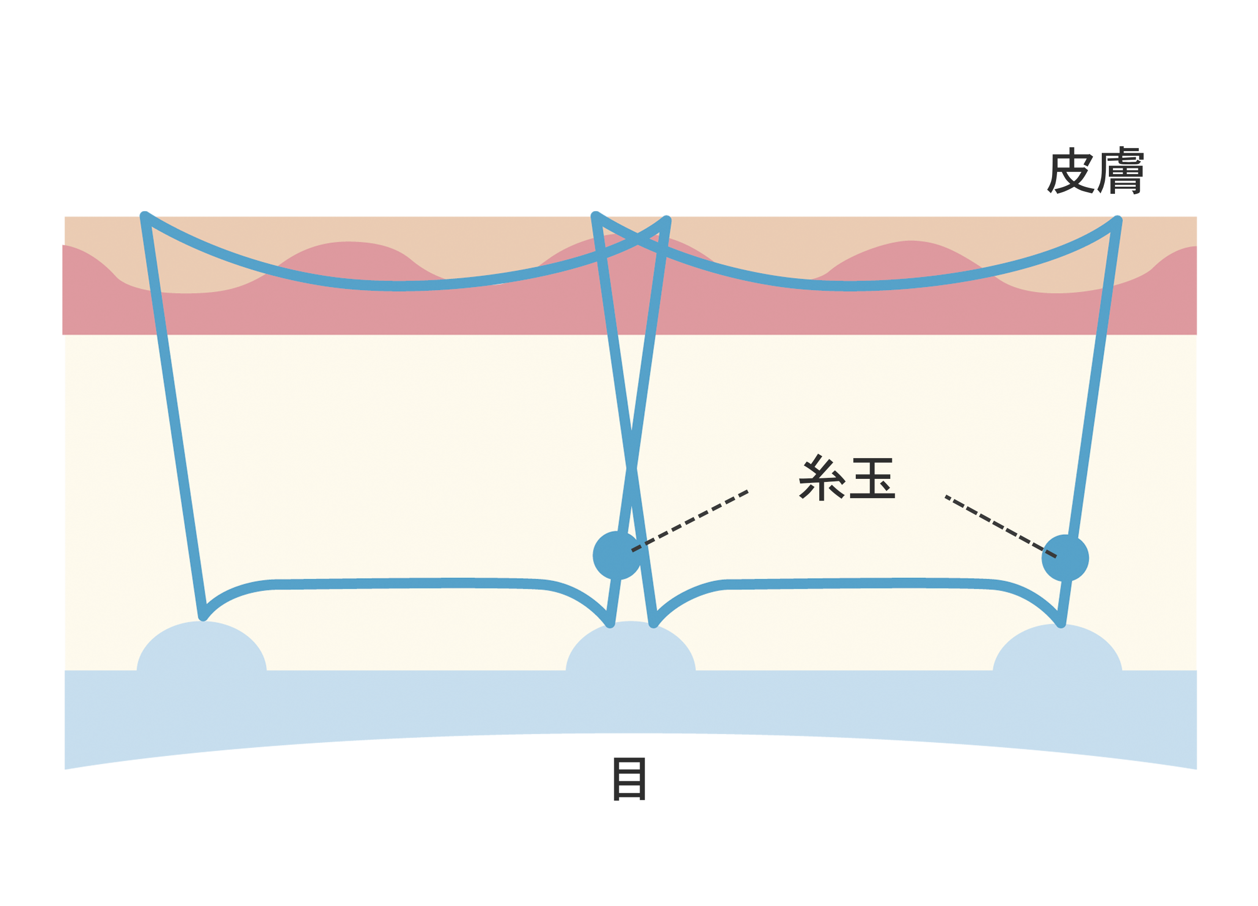 Zetith Eyes 二重埋没法 ゼティスビューティークリニック 鼻整形 鼻形成 美肌専門美容クリニック